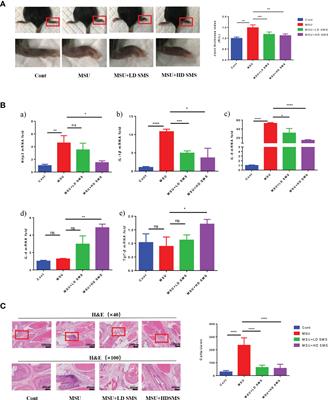 The Anti-Inflammatory and Uric Acid Lowering Effects of Si-Miao-San on Gout